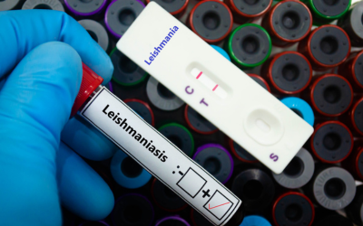 Image of a positive lab test for Leishmaniasis